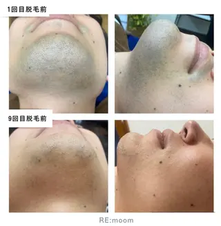 RE:moom リムーム/脱毛エステのエステ・リラクイメージ