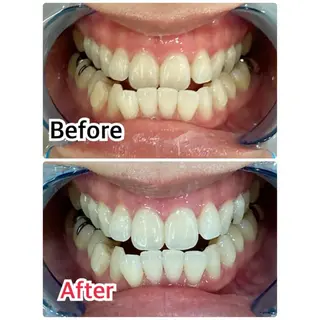 プラチナムビューティー柏所属・【歯科提携】柏ホワイ トニングスタイルのその他イメージ