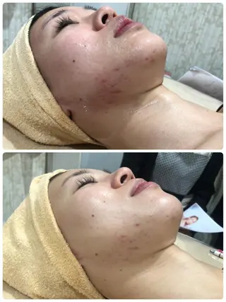 産後/ツヤ肌/子連れ /保育士在籍サロンのエステ・リラクイメージ