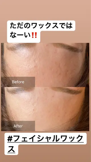 産毛専門店 Bittoのエステ・リラクイメージ