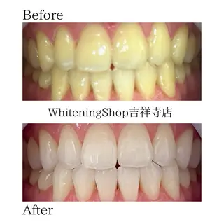 ホワイトニング ショップ吉祥寺店のエステ・リラクイメージ