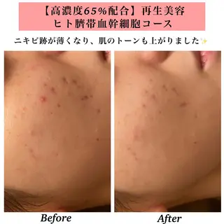 Bellesthe (ベルエステ)のエステ・リラクイメージ