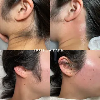 HOTEL&PARK . ワックス脱毛のエステ・リラクイメージ