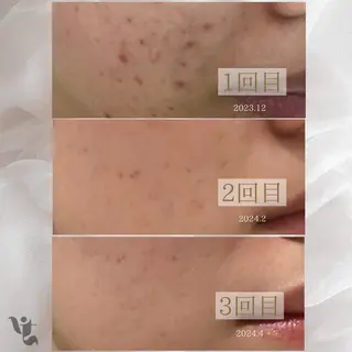 【vidyto】ヴィディトゥ所属・肌管理サロン vidyto MOEのエステ・リラクイメージ