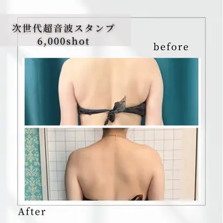 小顔矯正専門店 【RED】池田のエステ・リラクイメージ