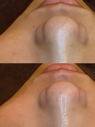 EARTH coiffure beaute 新潟紫竹山店所属・🤍アベシュリ /フェイシャル🤍のエステ・リラクイメージ