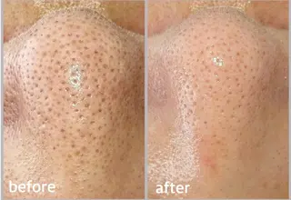 マツエク・マツパ 韓国肌管理 【毛穴専科】のエステ・リラクイメージ