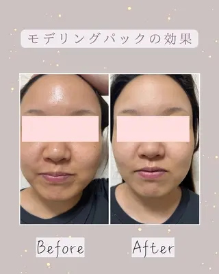 宮代・脱毛サロンMIIN所属・脱毛/ホワイトニング 美白ケア🫧MIINのエステ・リラクイメージ