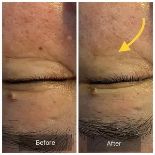 Mandarin Orange所属・毛穴から始める肌メン テマンダリンオレンジのエステ・リラクイメージ