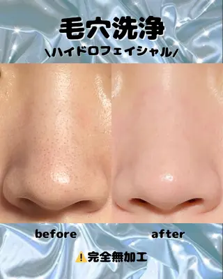 Diailes 💎ななのエステ・リラクイメージ