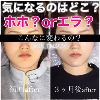 🌈歪み改善🌈 バリンタイ すぎうらのエステ・リラクイメージ