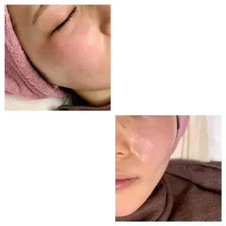 lafleur Yurinaのエステ・リラクイメージ