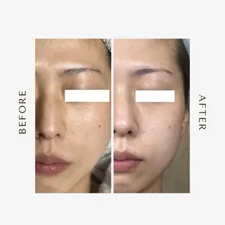 ROR Akariのエステ・リラクイメージ