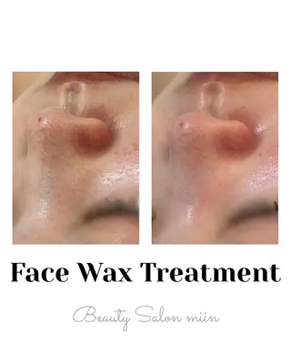 韓国肌管理 白玉肌管理®︎のエステ・リラクイメージ