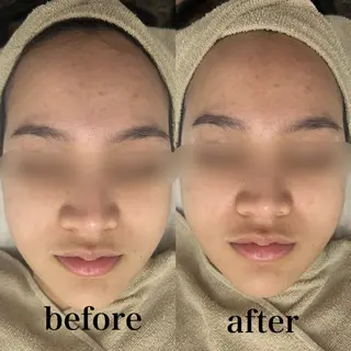 フェイシャルサロン CHIARA 荒田のエステ・リラクイメージ