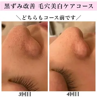 Bellesthe (ベルエステ)のエステ・リラクイメージ