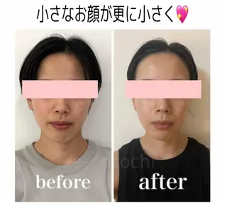 小顔と ヘッドスパのお店のエステ・リラクイメージ