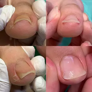 ネイル 東京巻き爪アカデミー所属・東京巻き爪 アカデミーのエステ・リラクイメージ