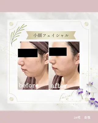美肌結果重視サロン addissimoのエステ・リラクイメージ