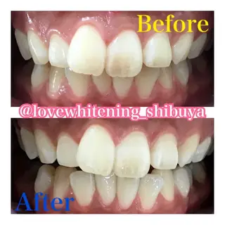 LOVE ホワイトニング渋谷のその他イメージ