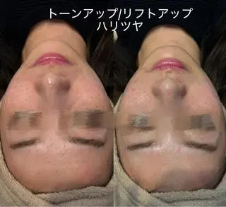 #美容革命ラボ 南堀江店のエステ・リラクイメージ