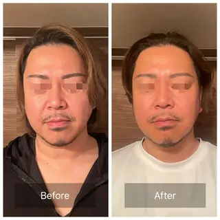 メンズ アイブロウ/脱毛/ 肌質改善🌷RINAの眉毛・アイブロウイメージ