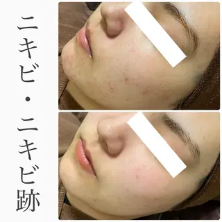 ハーブピーリング専門 BIOEL横浜のエステ・リラクイメージ