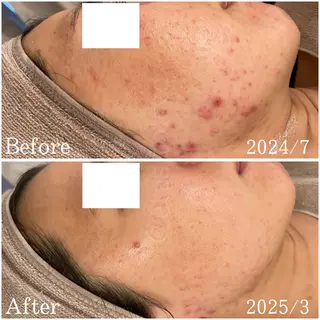 etes （エトエス）所属・etes.tokyo 中目黒のエステ・リラクイメージ