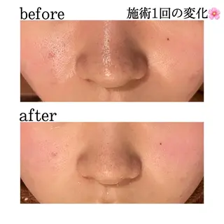 触れたくなる モテ肌へ...❤︎のエステ・リラクイメージ