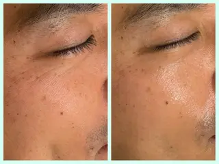 メンズ ☆痩身/小顔☆ 結果出します☆のエステ・リラクイメージ