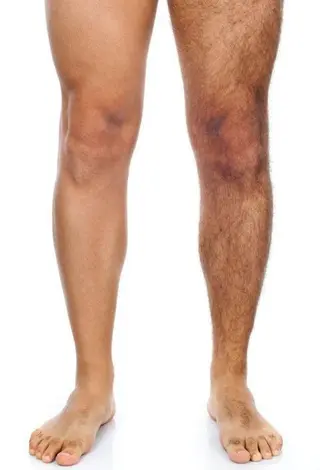 バストアップ・脱毛 🌺Ko Olinaのエステ・リラクイメージ