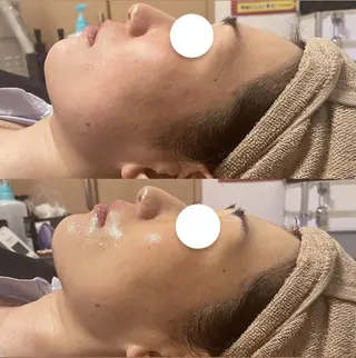 アイブロウ キッズ メンズ Epina 千葉店 【エピナ】のエステ・リラクイメージ