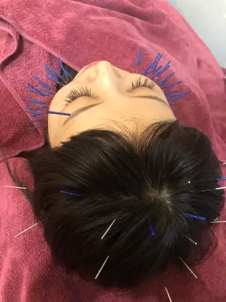 美容鍼灸女性専用 りんご鍼灸治療院のその他イメージ