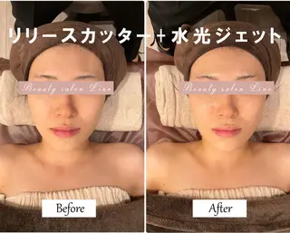 痩身×フェイシャル ブライダル|Linoのエステ・リラクイメージ