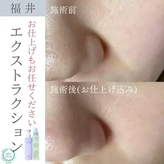 毛穴ケア専門サロン Yourmeユアミーのエステ・リラクイメージ