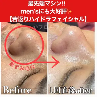 部分痩せ♥️小顔専門 MIKUのエステ・リラクイメージ