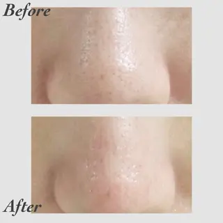 小顔・ツルツル素肌 ハリステリアのエステ・リラクイメージ