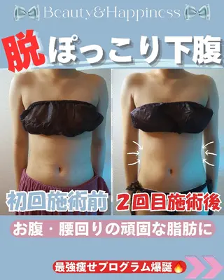 痩身ハーブピーリング 筋膜リリース☆B&Hのエステ・リラクイメージ