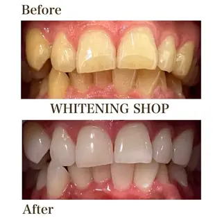 ホワイトニングショップ伊丹店所属・ホワイトニング ショップ伊丹店のその他イメージ