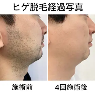 メンズ 佐田 優華のエステ・リラクイメージ