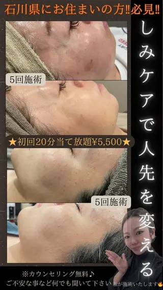 LiZA エステティックサロンのエステ・リラクイメージ