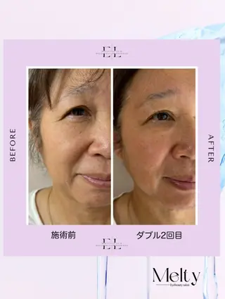 Melty eye beauty salon所属・平岡 みづきのマツエク・マツパデザイン