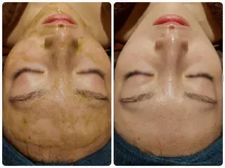 MyFairLady miuのエステ・リラクイメージ