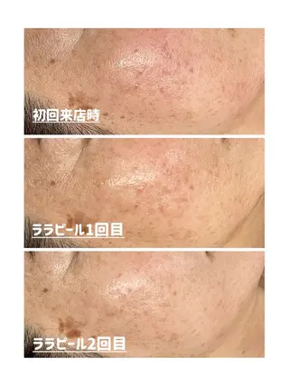 Leisurely レイジュアリーのエステ・リラクイメージ