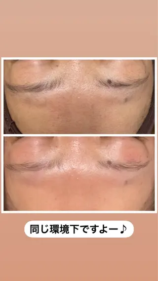 産毛専門店 Bittoのエステ・リラクイメージ