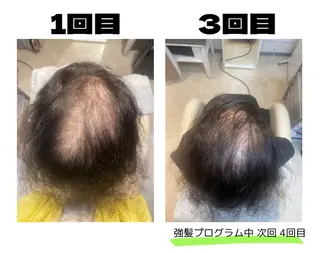 GRAZIE所属・女性専門だから安心 【育毛増毛専門店】のヘアスタイル