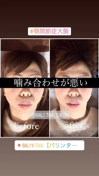 🌈歪み改善🌈 バリンタイ すぎうらのエステ・リラクイメージ