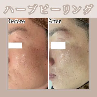 メンズ キッズ Amaryllis 🌹松本のエステ・リラクイメージ