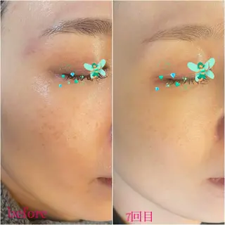 フィユ所属・〚博多〛フィユ 水江のマツエク・マツパデザイン