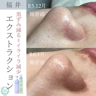 毛穴ケア専門サロン Yourmeユアミーのエステ・リラクイメージ